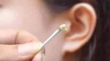 Comment enlever un bouchon d’oreille naturellement ?